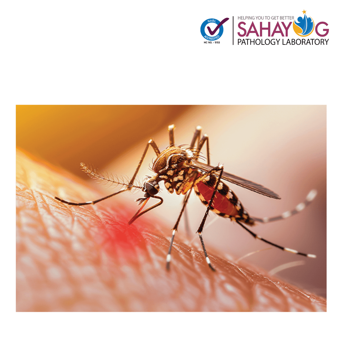 Dengue profile